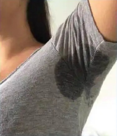 Before miraDry: a gray shirt with a visible underarm sweat stain