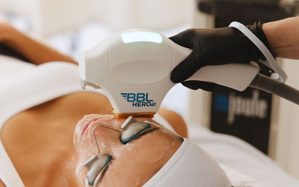 A BBL HEROic treatment with the Sciton platform