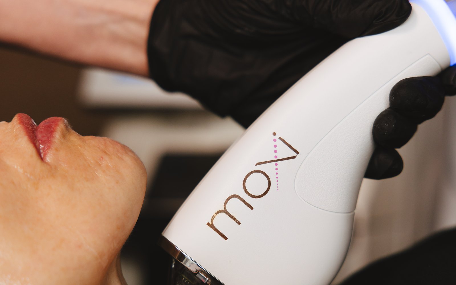 A MOXI treatment with the Sciton platform